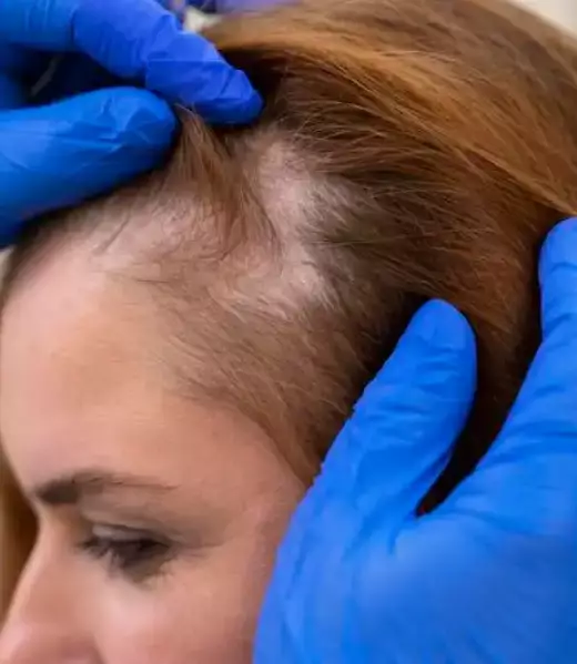 solution-dermopigmentation-cheveux-femme solution-dermopigmentation-cheveux-femme